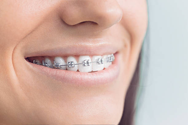 Best Traditional Braces  in Midway, NC